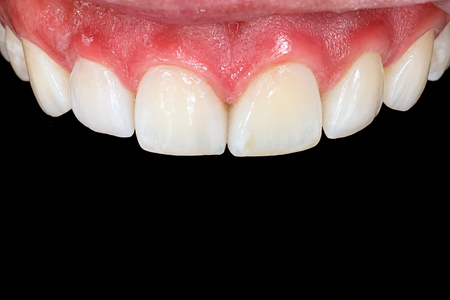 CASOS PERIODONCIA (8)-1