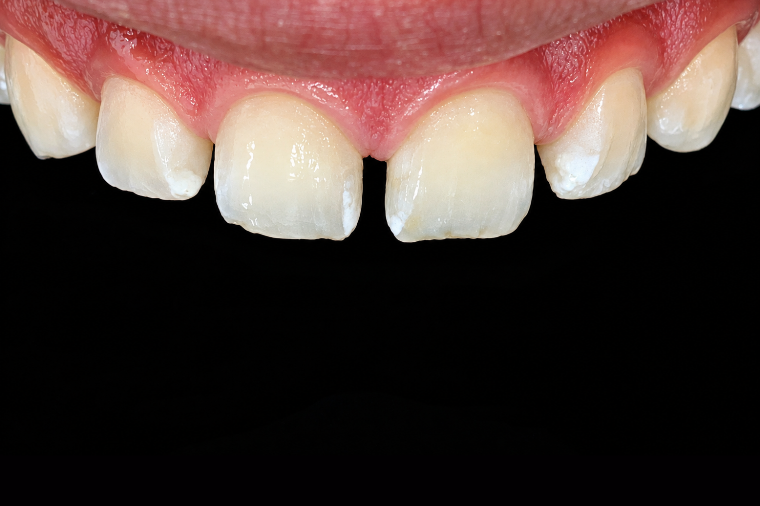 CASOS PERIODONCIA (9)