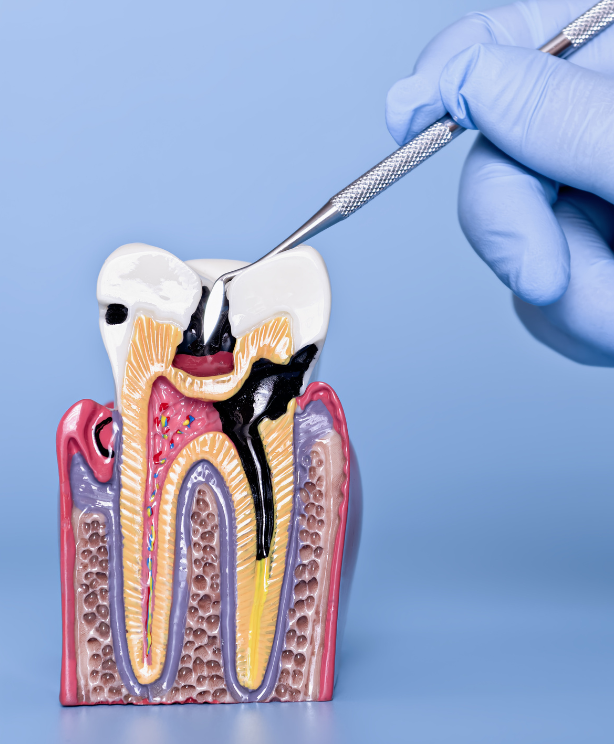 periodoncia-clinica-dental-miraflores