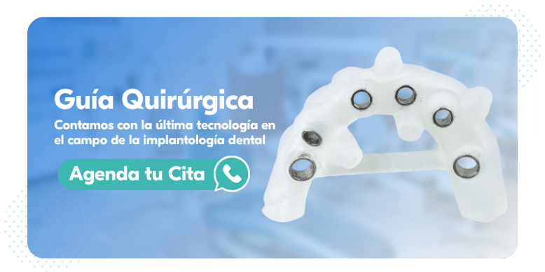 implante-dental-movimiento-sonrisas