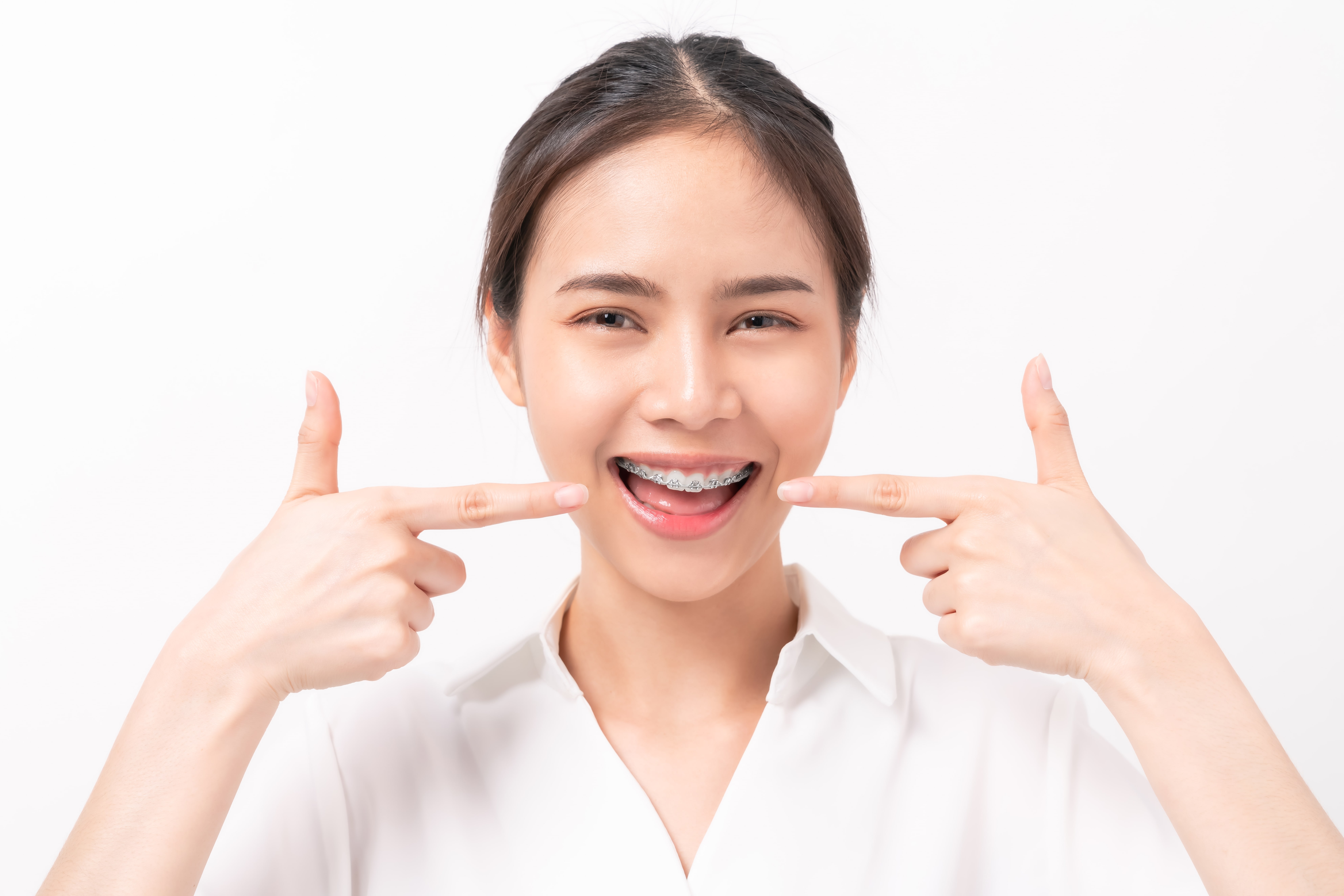 face-of-a-young-smiling-asian-woman-with-braces-on-2023-11-27-04-53-14-utc-min