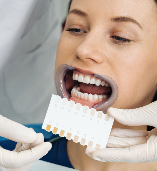 movimientosonrisas-blanqueamiento-dental-(1)