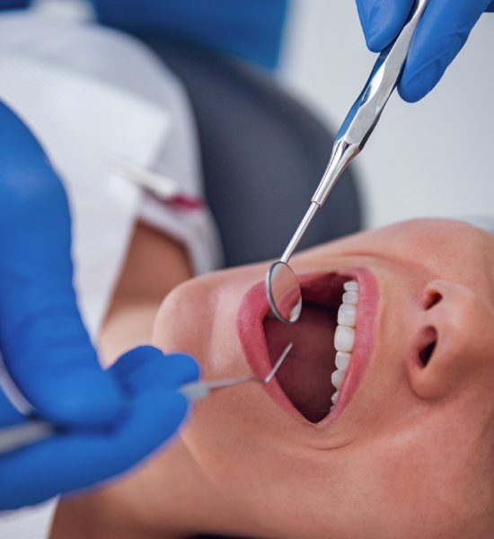 movimientosonrisas-limpieza-dental-(1)