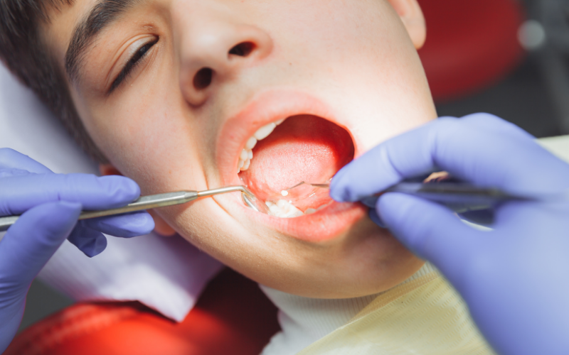 clinica-dental-miraflores-periodoncia-gingivitis-encias