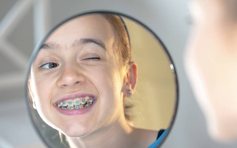 clinica-dental-miraflores-ortodoncia-niños-brackets