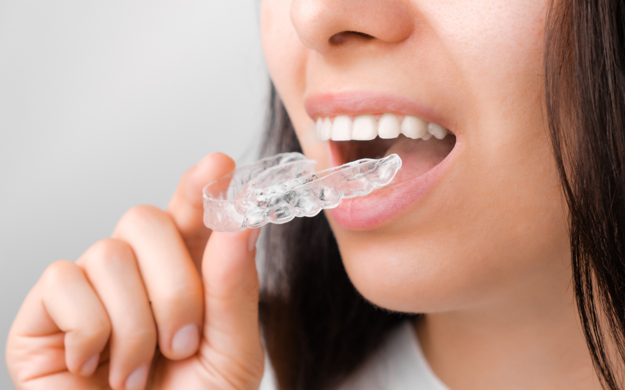 clinica-dental-miraflores-ortodoncia