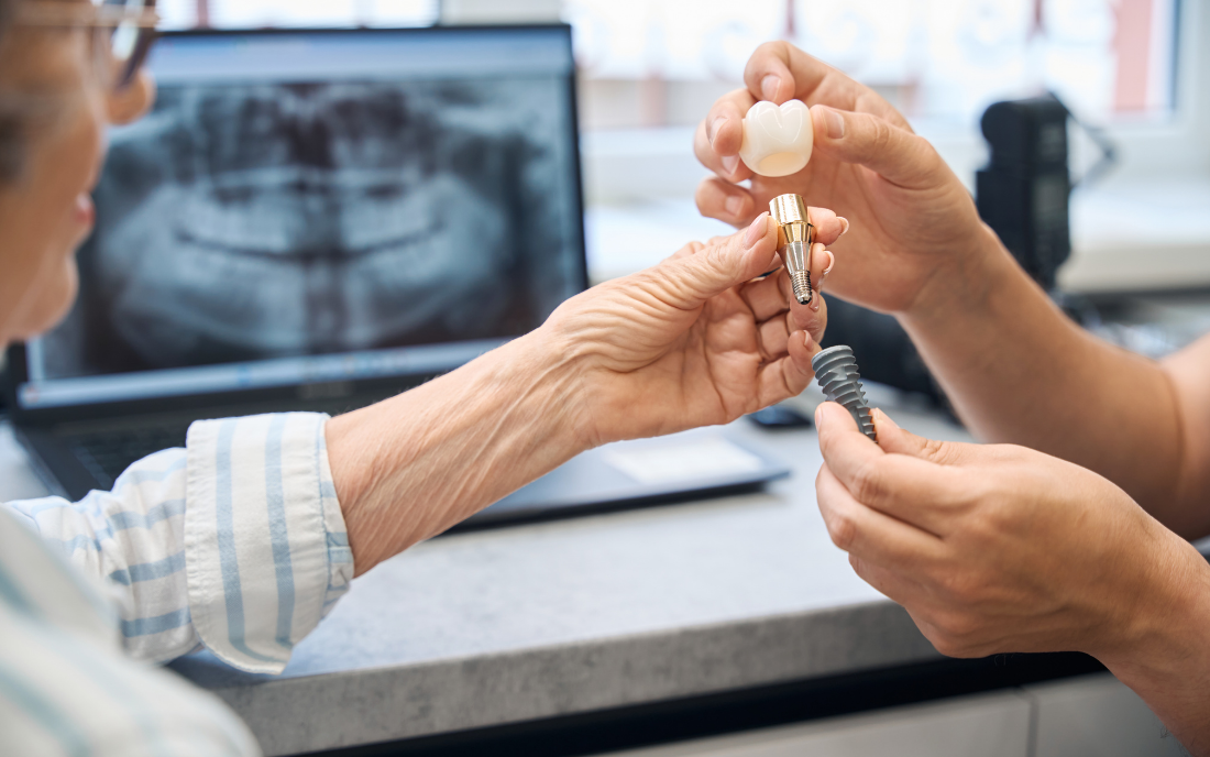 clinica-dental-miraflores-implantes-dentales