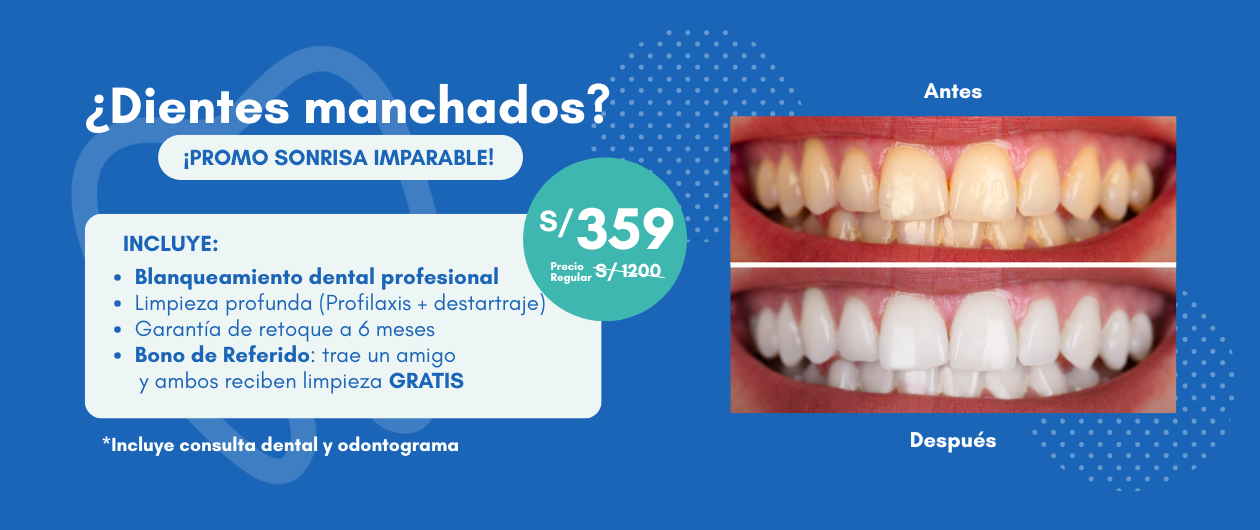 SONRISA IMPARABLE (5)