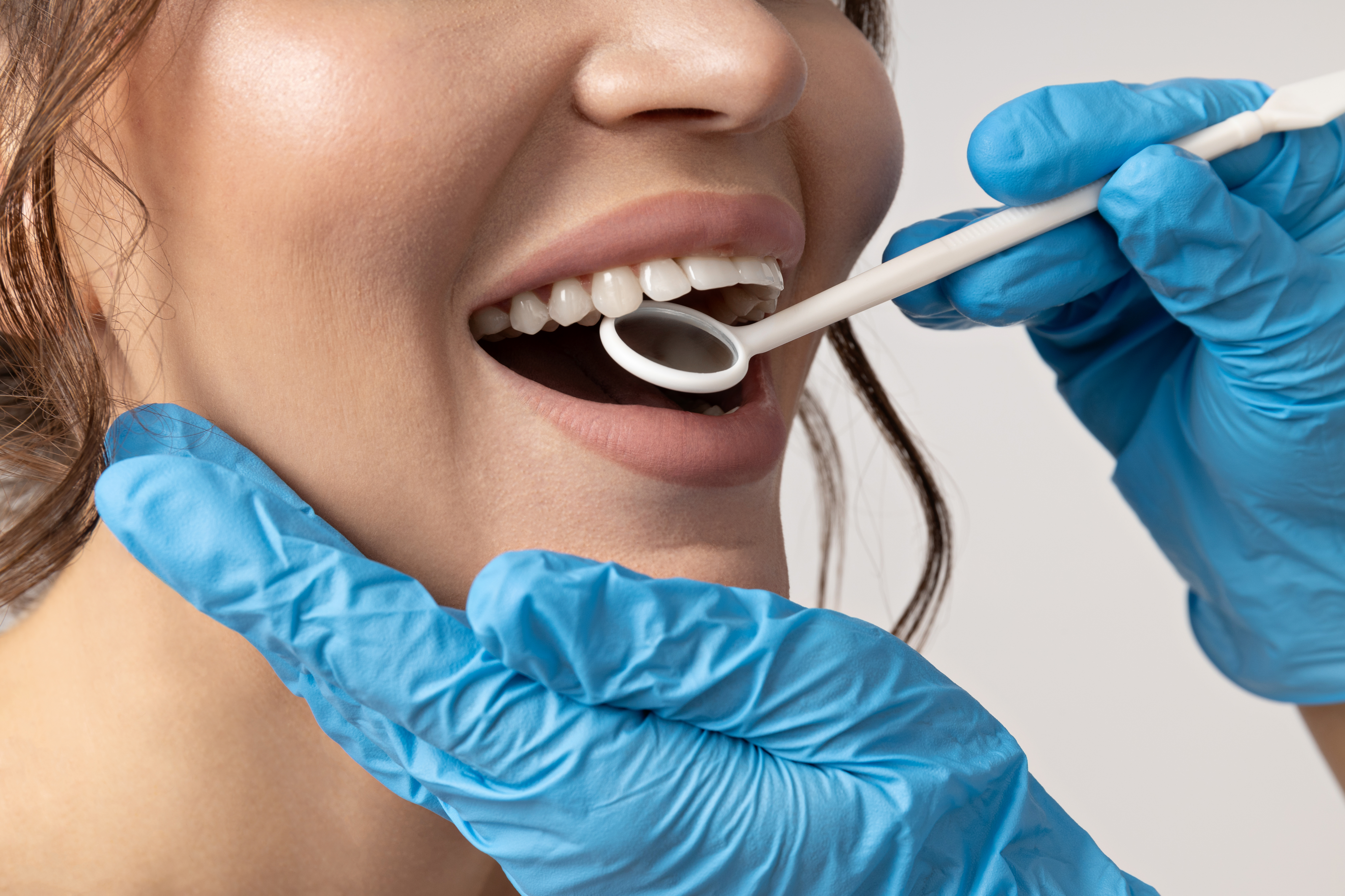 Contorneado estético dental para equilibrar la sonrisa en Lima — Movimiento Sonrisas.