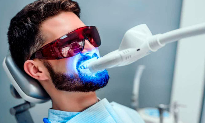 blanqueamiento laser