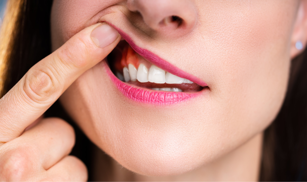 periodoncia-miraflores-movimiento-sonrisas